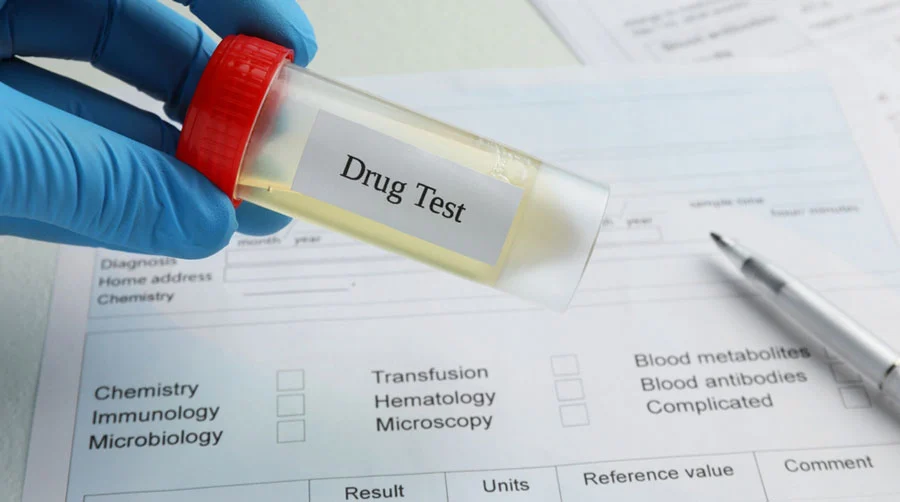 Drug Test