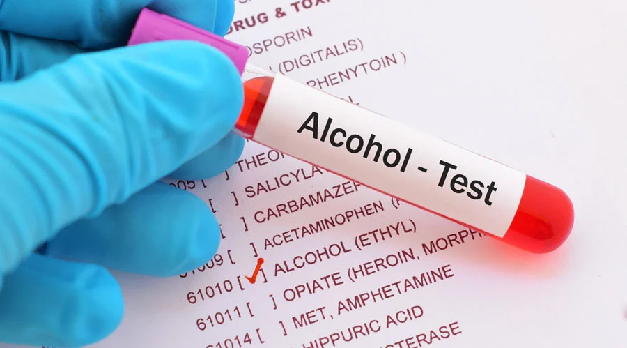 Positive Drug Tests for Alcohol